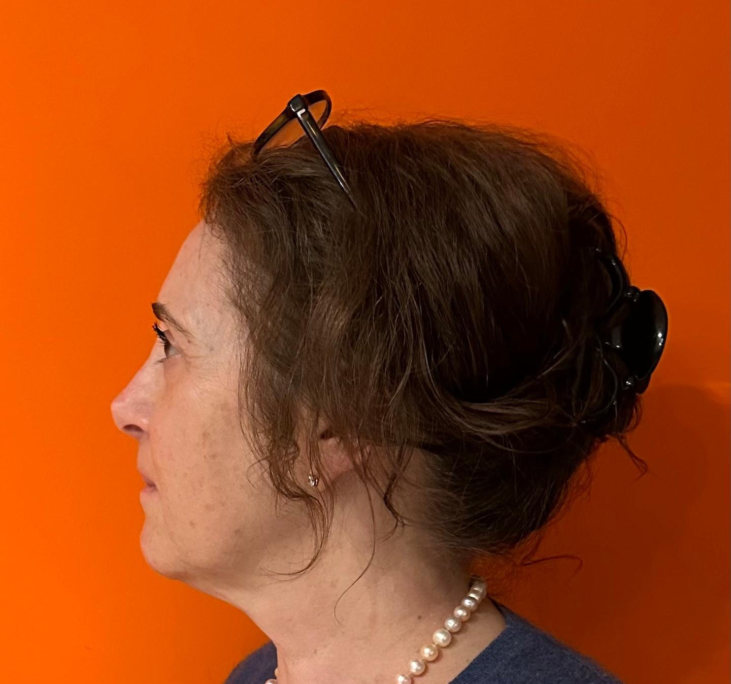 orderedImageAlt_ha_default